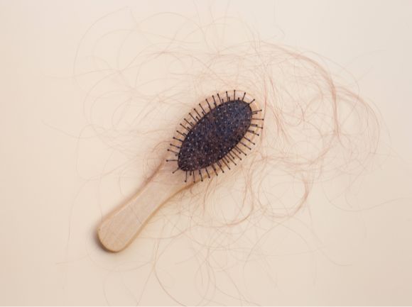 PERDITA DI CAPELLI prevenzione e rimedi